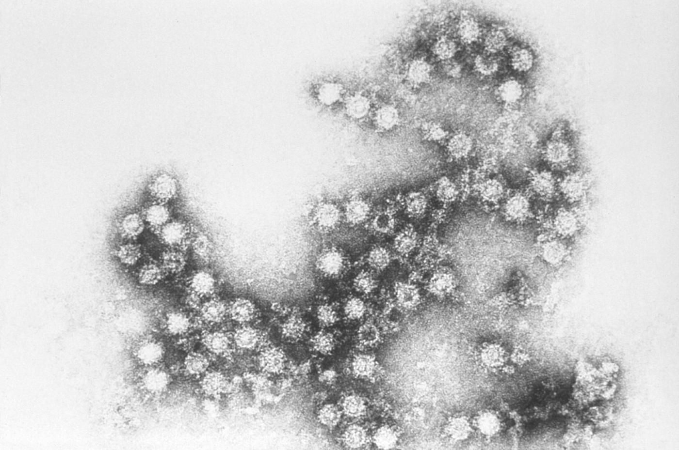 Micrografia eletrônica do coxsackievírus B4