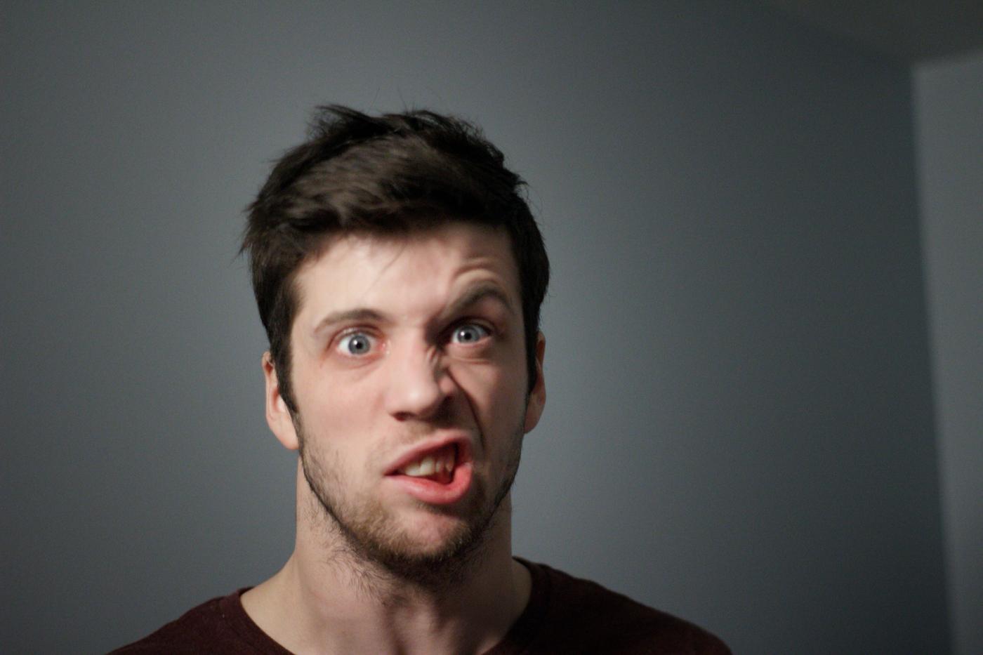 Homem com paralisia facial tentando mostrar os dentes